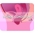 Vaginal Conditions